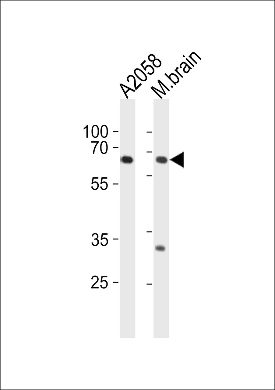 Western blot analysis in A2058 cell line and mouse brain tissue lysates (35ug/lane) .