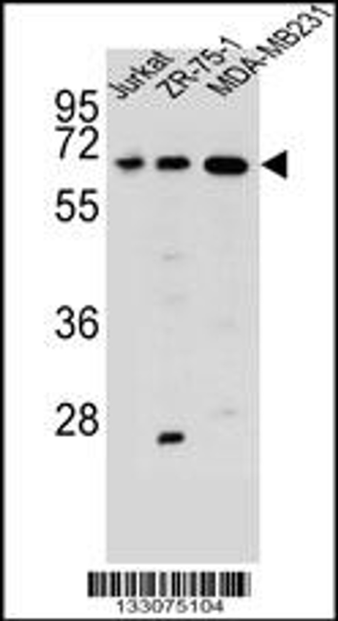 Western blot analysis in Jurkat, ZR-75-1, MDA-MB231 cell line lysates (35ug/lane) .