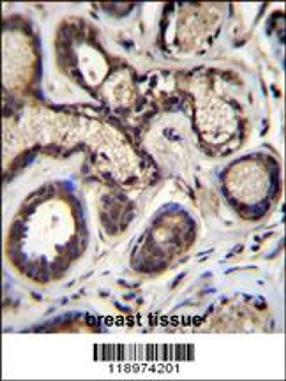 EIF2B5 Antibody immunohistochemistry analysis in formalin fixed and paraffin embedded human breast tissue followed by peroxidase conjugation of the secondary antibody and DAB staining.