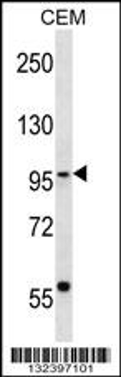 Western blot analysis in CEM cell line lysates (35ug/lane) .