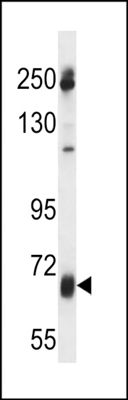 Western blot analysis in uterus tumor cell line lysates (35ug/lane) .