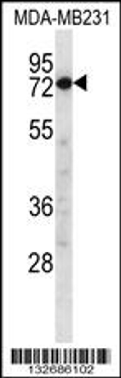 Western blot analysis in MDA-MB231 cell line lysates (35ug/lane) .