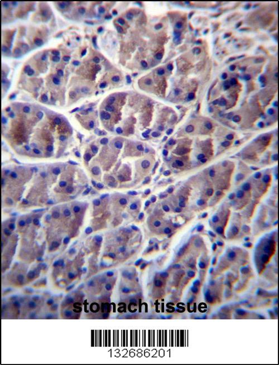 CAPN8 Antibody immunohistochemistry analysis in formalin fixed and paraffin embedded human stomach tissue followed by peroxidase conjugation of the secondary antibody and DAB staining.