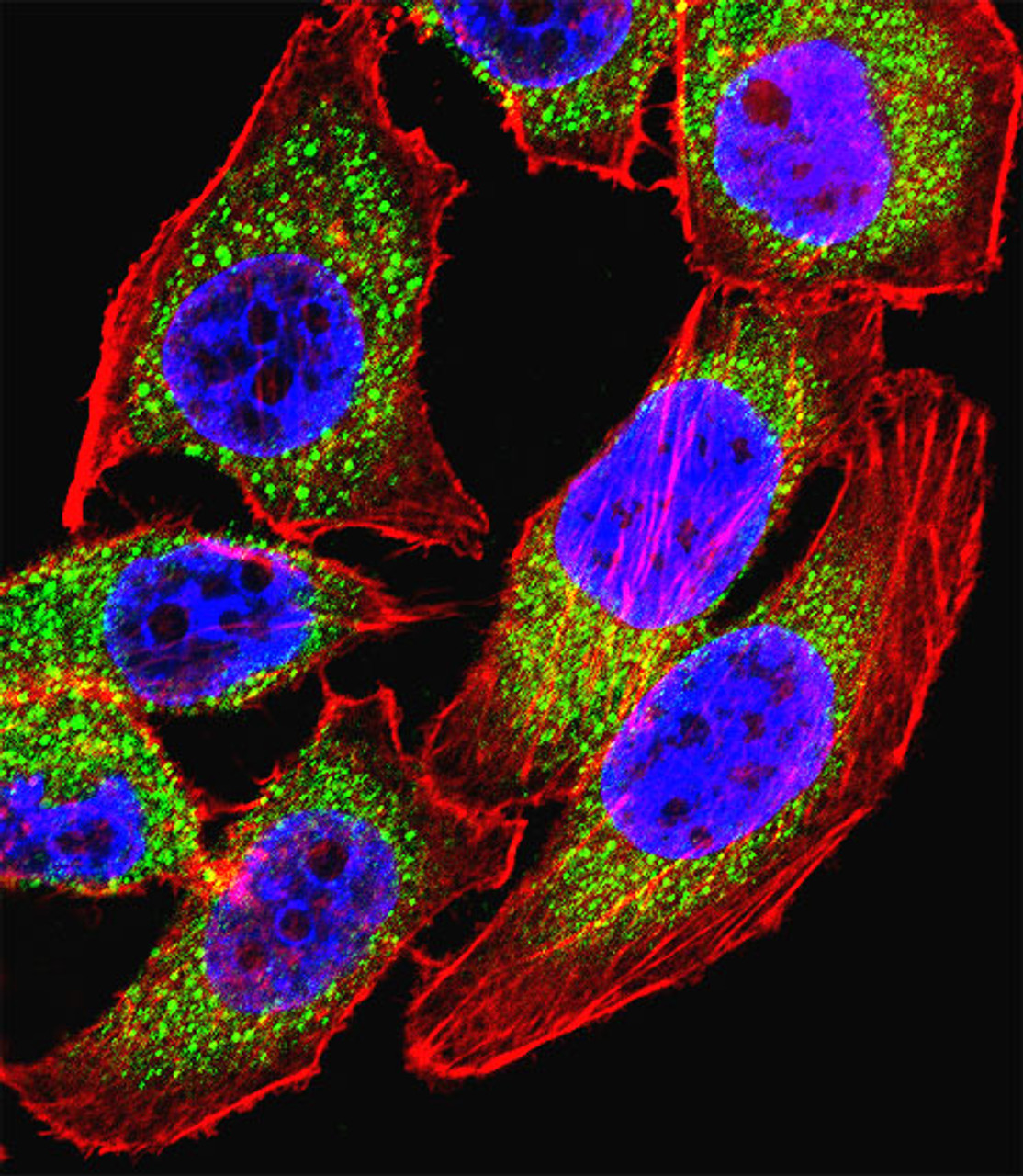 Fluorescent confocal image of U251 cell stained with NFATC4 Antibody .U251 cells were fixed with 4% PFA (20 min) , permeabilized with Triton X-100 (0.1%, 10 min) , then incubated with NFATC4 primary antibody (1:25) . For secondary antibody, Alexa Fluor 488 conjugated donkey anti-rabbit antibody (green) was used (1:400) .Cytoplasmic actin was counterstained with Alexa Fluor 555 (red) conjugated Phalloidin (7units/ml) . Nuclei were counterstained with DAPI (blue) (10 ug/ml, 10 min) . NFATC4 immunoreactivity is localized to Cytoplasm significantly.