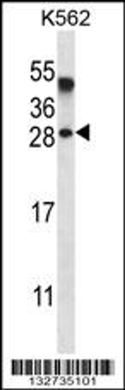 Western blot analysis in K562 cell line lysates (35ug/lane) .