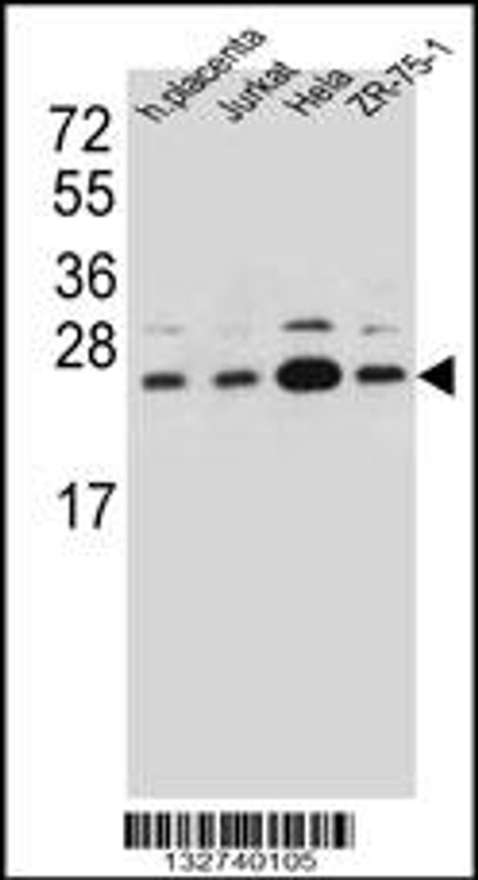 Western blot analysis in human placenta tissue and Jurkat, Hela, ZR-75-1 cell line lysates (35ug/lane) .