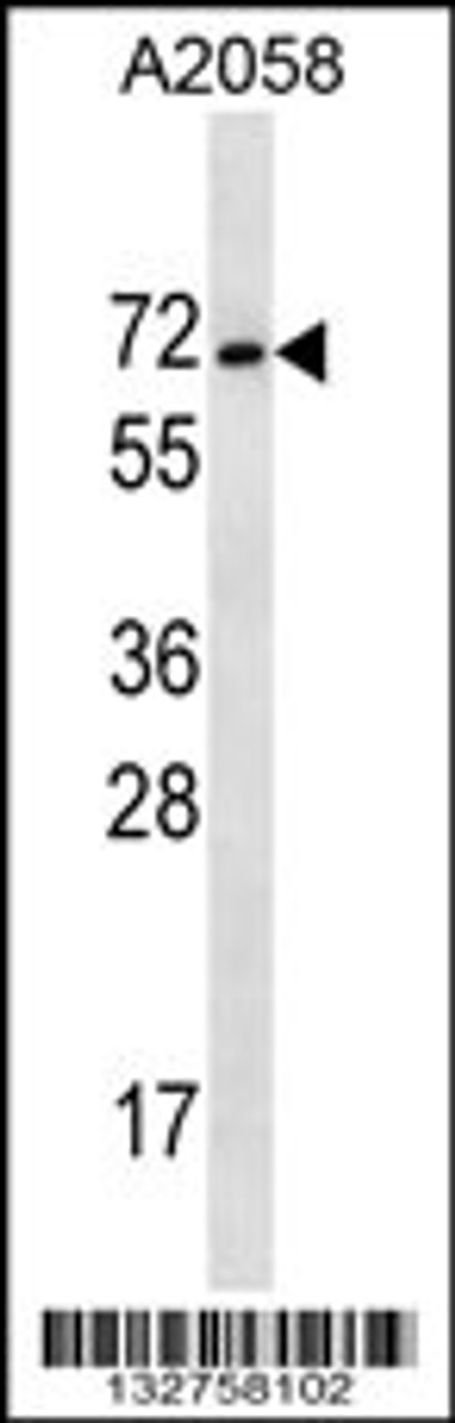 Western blot analysis in A2058 cell line lysates (35ug/lane) .