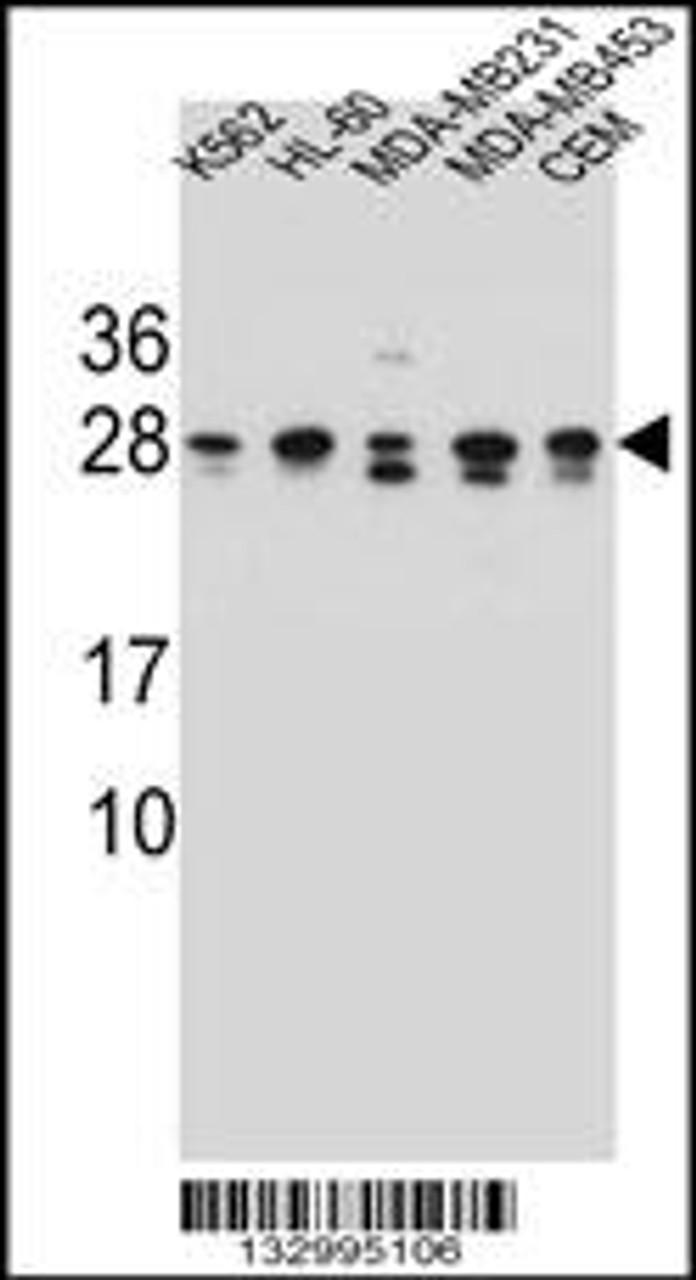 Western blot analysis in K562, HL-60, MDA-MB231, MDA-MB453, CEM cell line lysates (35ug/lane) .