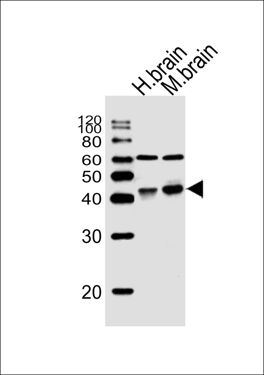 Western blot analysis of lysates from human brain, mouse brain tissue (from left to right) , using WNT16 Antibody at 1:1000 at each lane.