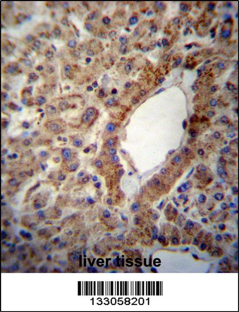ACSS2 Antibody immunohistochemistry analysis in formalin fixed and paraffin embedded human liver tissue followed by peroxidase conjugation of the secondary antibody and DAB staining.