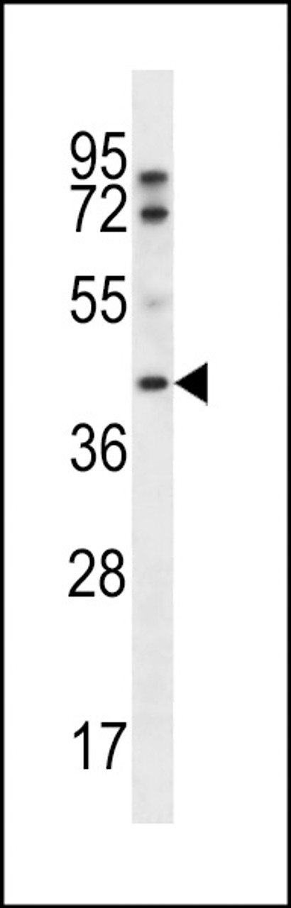 Western blot analysis in A2058 cell line lysates (35ug/lane) .