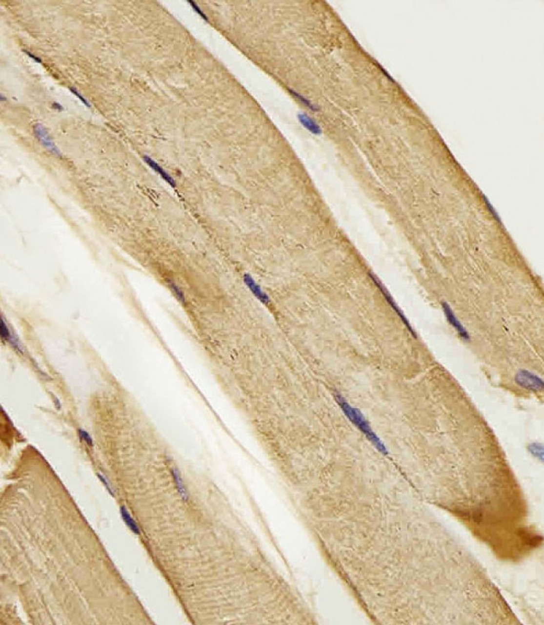 Antibody staining SLC16A10 in Human skeletal muscle tissue sections by Immunohistochemistry (IHC-P - paraformaldehyde-fixed, paraffin-embedded sections) .