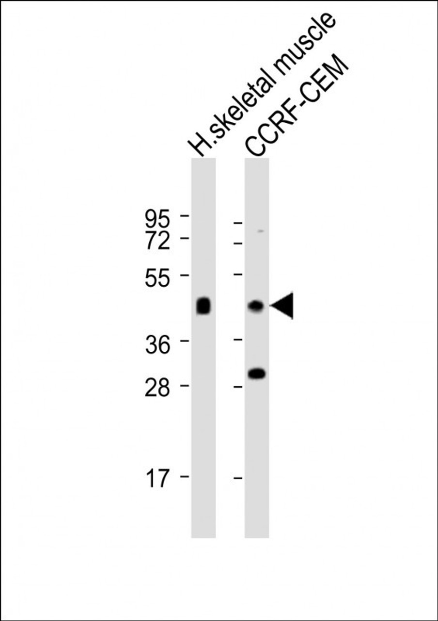 Western Blot at 1:2000 dilution Lane 1: human skeletal muscle lysates Lane 2: CCRF-CEM whole cell lysates Lysates/proteins at 20 ug per lane.