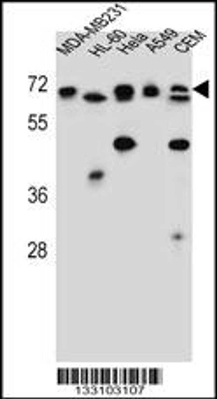 Western blot analysis in MDA-MB231, HL-60, Hela, A549, CEM cell line lysates (35ug/lane) .