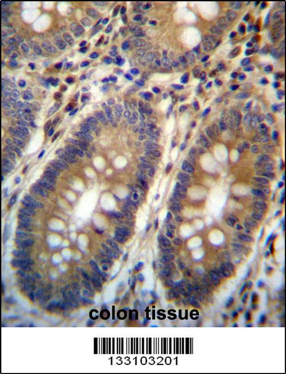 ASMTL Antibody immunohistochemistry analysis in formalin fixed and paraffin embedded human colon tissue followed by peroxidase conjugation of the secondary antibody and DAB staining.