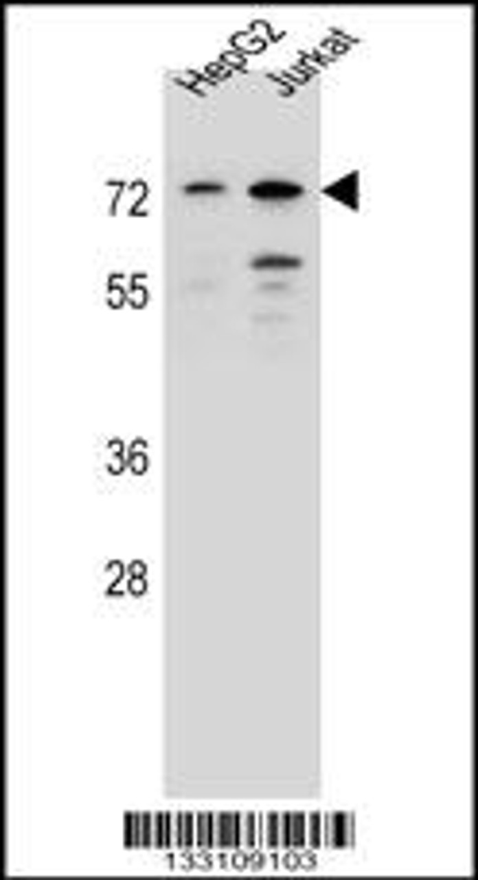 Western blot analysis in HepG2, Jurkat cell line lysates (35ug/lane) .