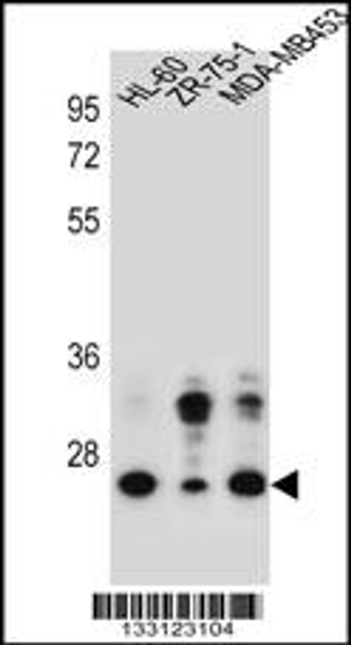 Western blot analysis in HL-60, ZR-75-1, MDA-MB453 cell line lysates (35ug/lane) .