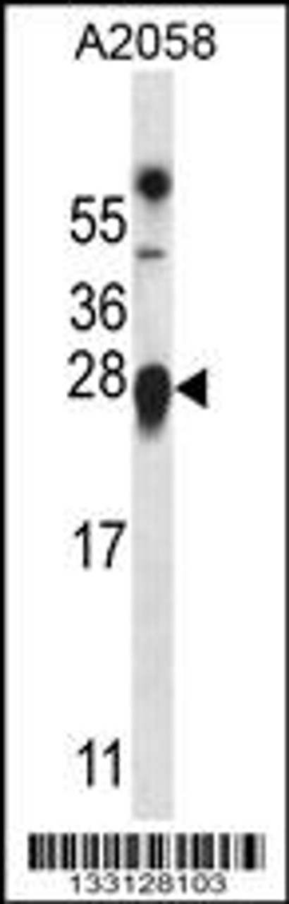 Western blot analysis in A2058 cell line lysates (35ug/lane) .