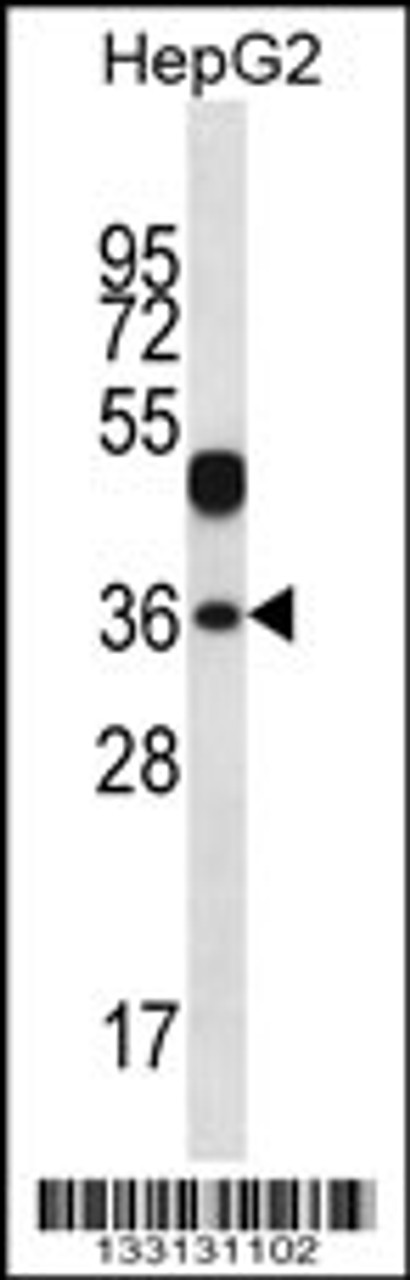 Western blot analysis in HepG2 cell line lysates (35ug/lane) .