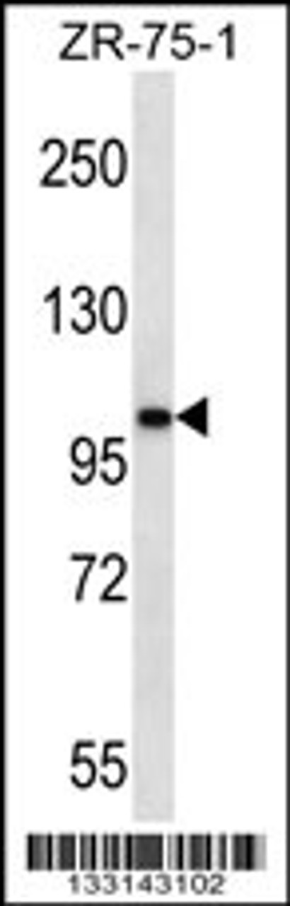 Western blot analysis in ZR-75-1 cell line lysates (35ug/lane) .This demonstrates the detected the AR protein (arrow) .