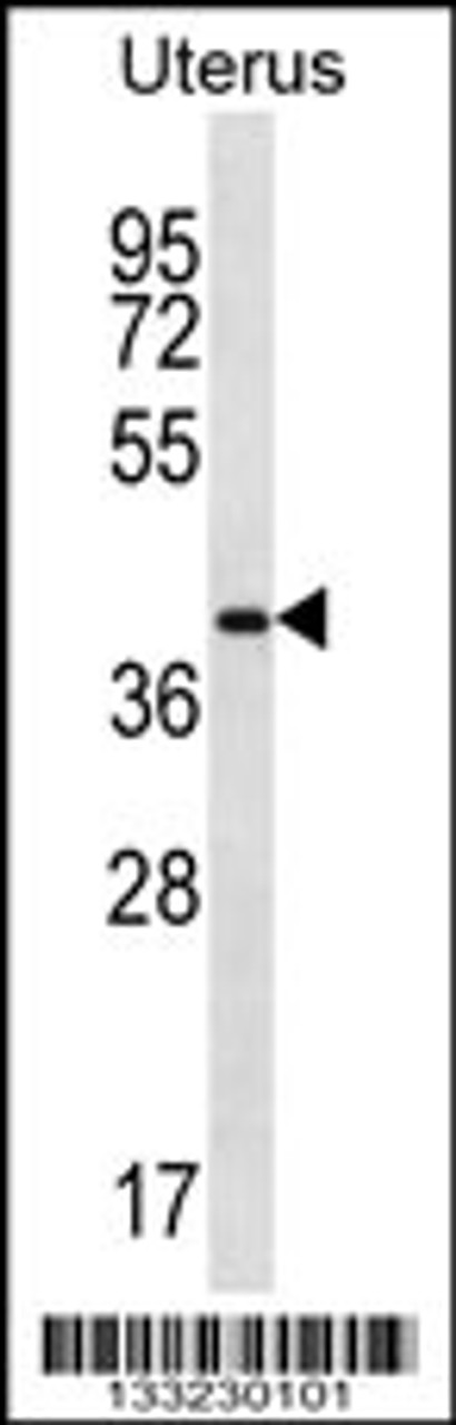 Western blot analysis in human normal Uterus tissue lysates (35ug/lane) .