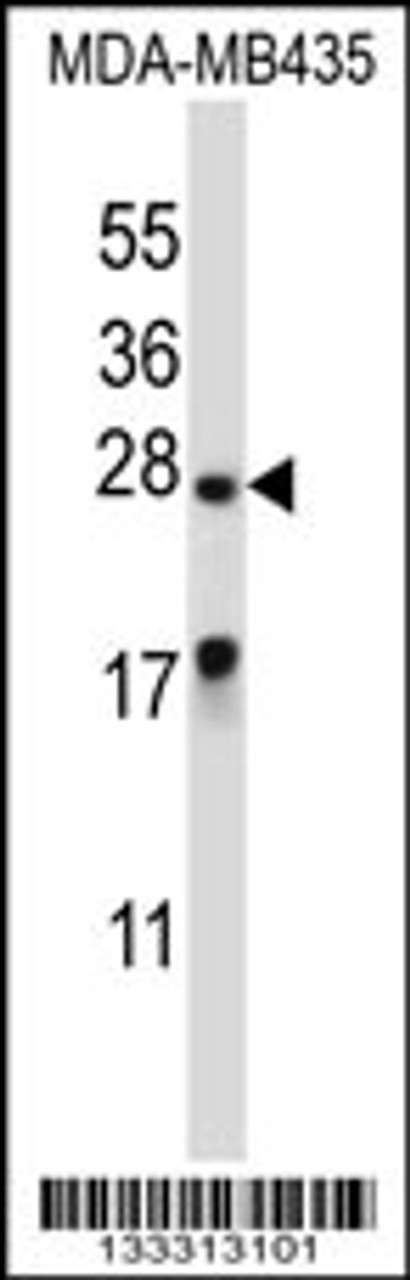 Western blot analysis in MDA-MB435 cell line lysates (35ug/lane) .This demonstdetected the MEA1 protein (arrow) .