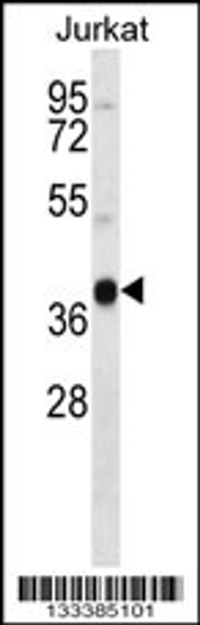 Western blot analysis in Jurkat cell line lysates (35ug/lane) .