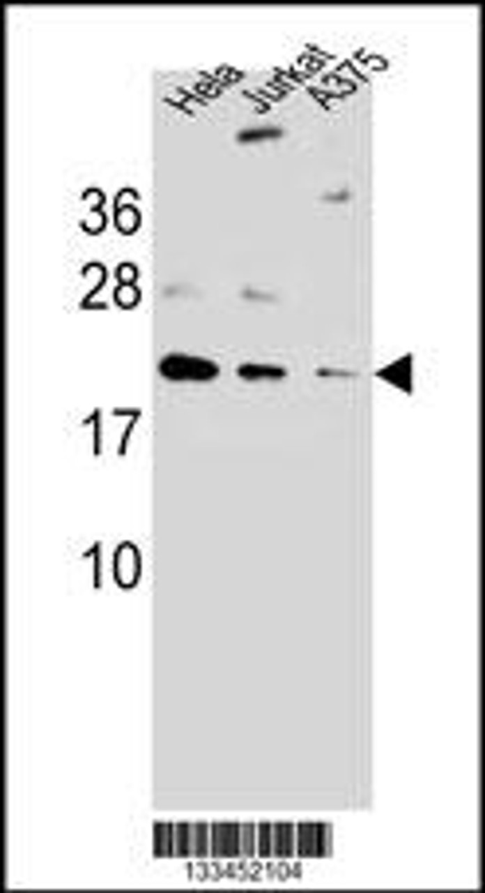 Western blot analysis in A375, Hela, Jurkat cell line lysates (35ug/lane) .This demonstrates the Adetected the ARL6IP6 protein (arrow) .