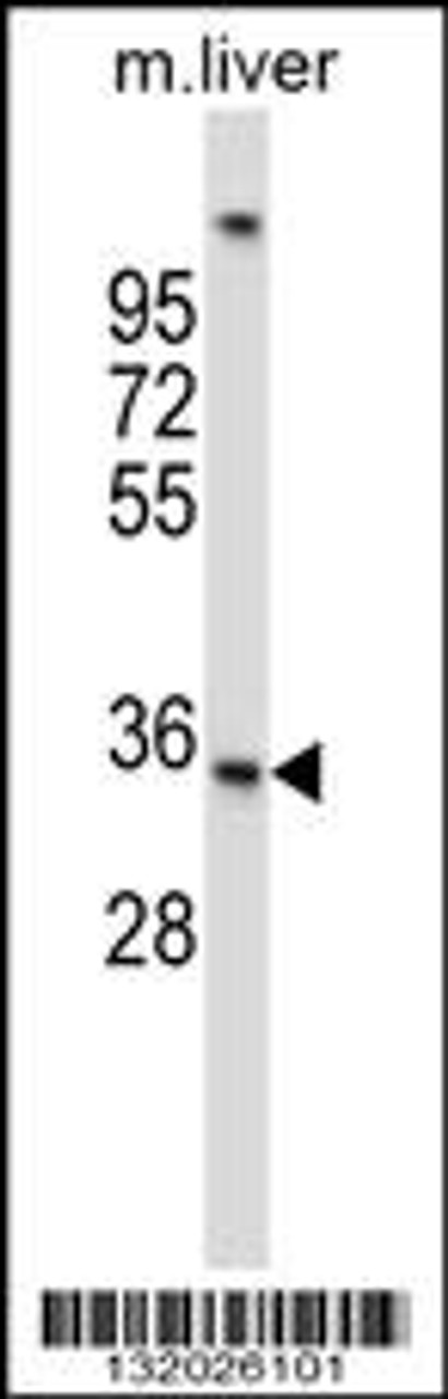 Western blot analysis in mouse liver tissue lysates (35ug/lane) .