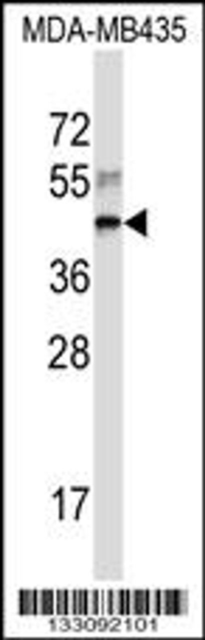 Western blot analysis in MDA-MB435 cell line lysates (35ug/lane) .