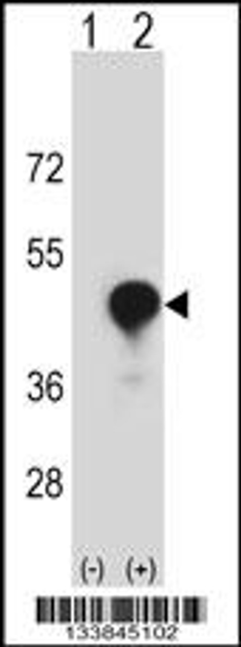 Western blot analysis of CD1C using rabbit polyclonal CD1C Antibody using 293 cell lysates (2 ug/lane) either nontransfected (Lane 1) or transiently transfected (Lane 2) with the CD1C gene.