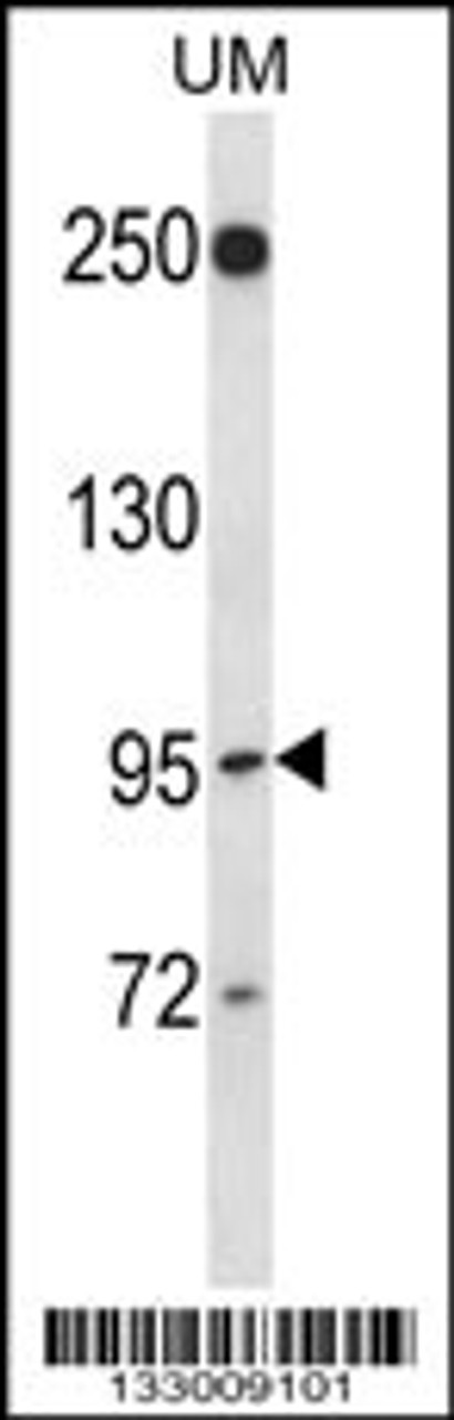 Western blot analysis in uterine tumor cell line lysates (35ug/lane) .