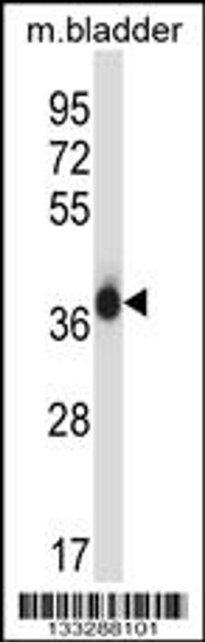 Western blot analysis in mouse bladder tissue lysates (35ug/lane) .