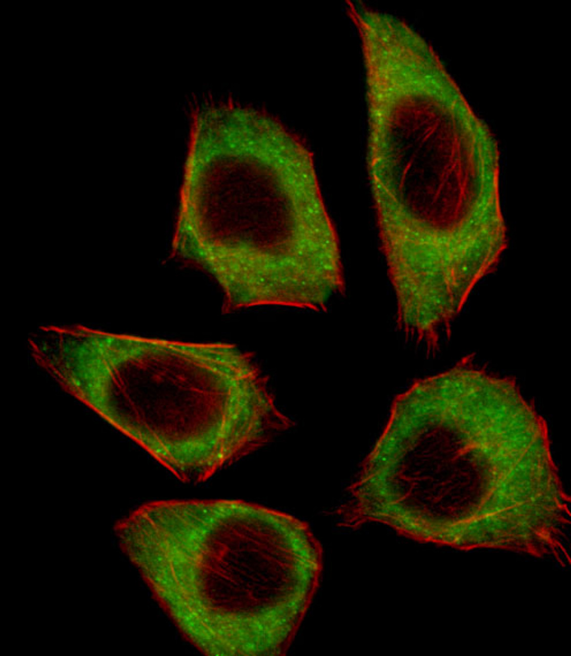 Fluorescent image of A549 cell stained with CSRNP2 Antibody .A549 cells were fixed with 4% PFA (20 min) , permeabilized with Triton X-100 (0.1%, 10 min) , then incubated with CSRNP2 primary antibody (1:25) . For secondary antibody, Alexa Fluor 488 conjugated donkey anti-rabbit antibody (green) was used (1:400) .Cytoplasmic actin was counterstained with Alexa Fluor 555 (red) conjugated Phalloidin (7units/ml) .CSRNP2 immunoreactivity is localized to Cytoplasm significantly.