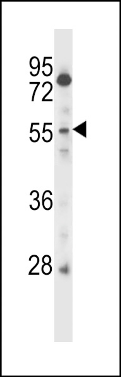 Western blot analysis in CEM cell line lysates (35ug/lane) .