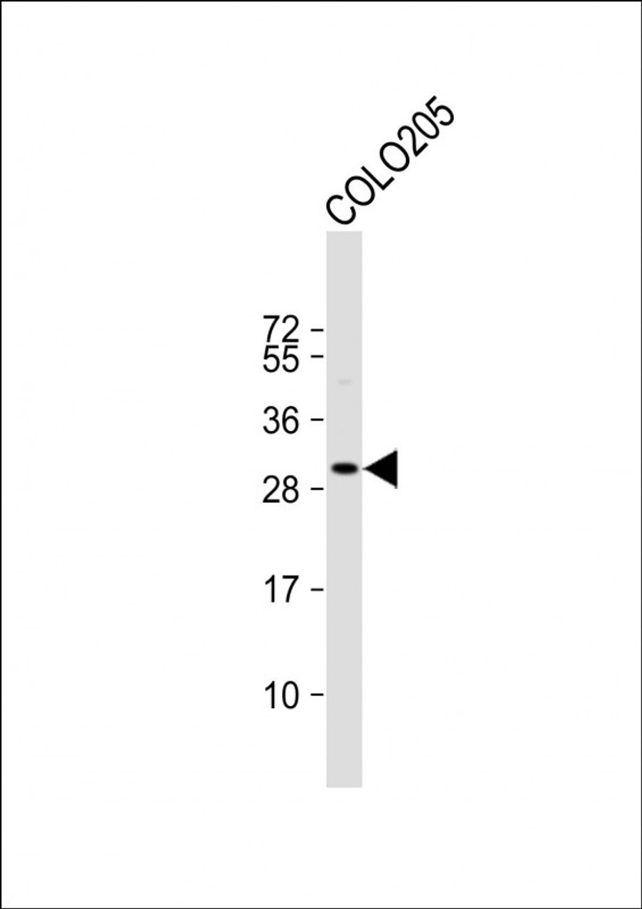 Western Blot at 1:1000 dilution + COLO205 whole cell lysate Lysates/proteins at 20 ug per lane.