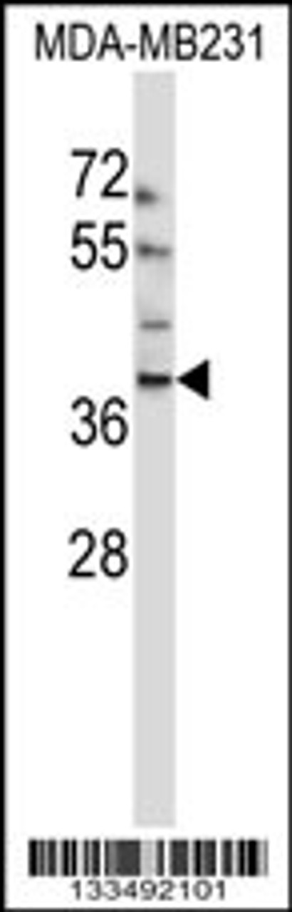 Western blot analysis in MDA-MB231 cell line lysates (35ug/lane) .