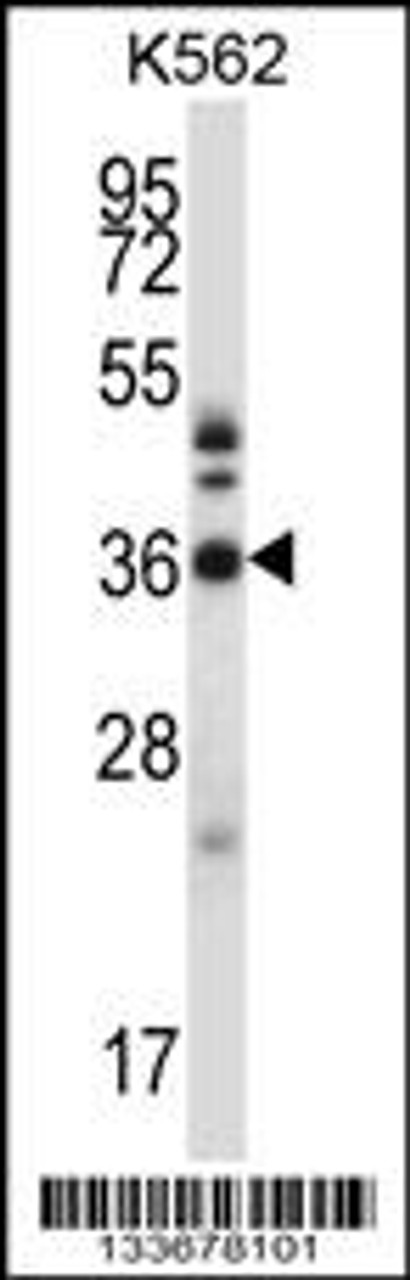 Western blot analysis in K562 cell line lysates (35ug/lane) .