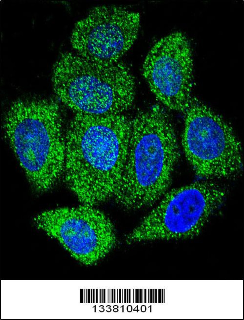 Confocal immunofluorescent analysis of IMPDH1 Antibody with Hela cell followed by Alexa Fluor 488-conjugated goat anti-rabbit lgG (green) . DAPI was used to stain the cell nuclear (blue) .