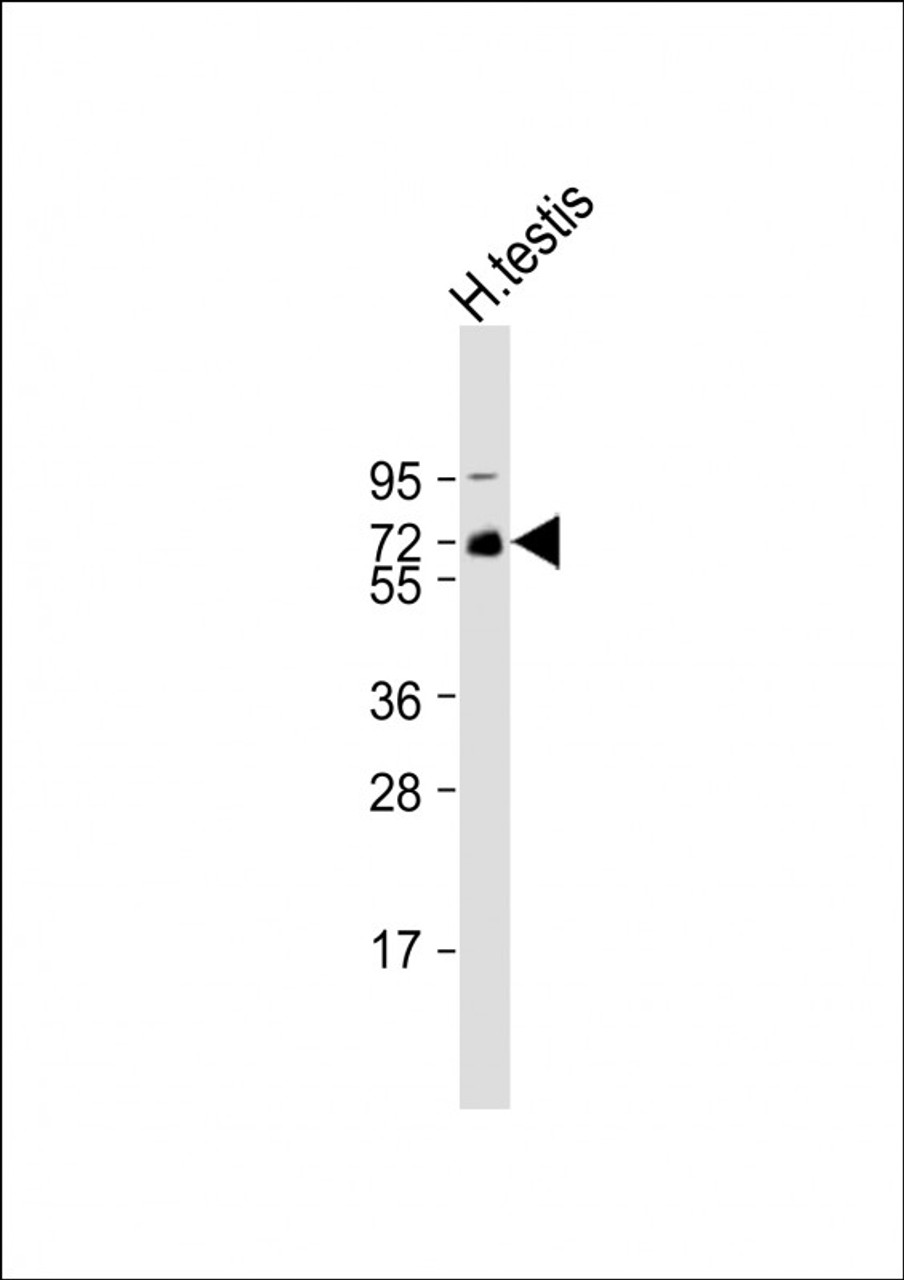 Western Blot at 1:1000 dilution + human testis lysate Lysates/proteins at 20 ug per lane.