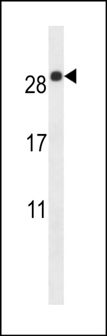 Western blot analysis in mouse lung tissue lysates (35ug/lane) .