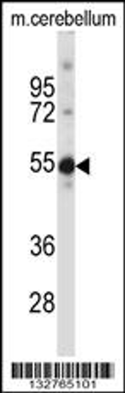 Western blot analysis in mouse cerebellum tissue lysates (35ug/lane) .