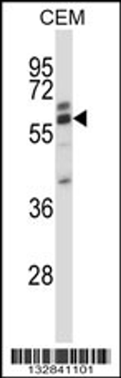 Western blot analysis in CEM cell line lysates (35ug/lane) .