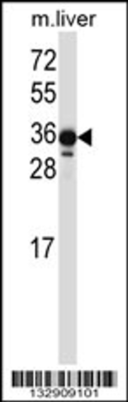 Western blot analysis in mouse liver tissue lysates (35ug/lane) .