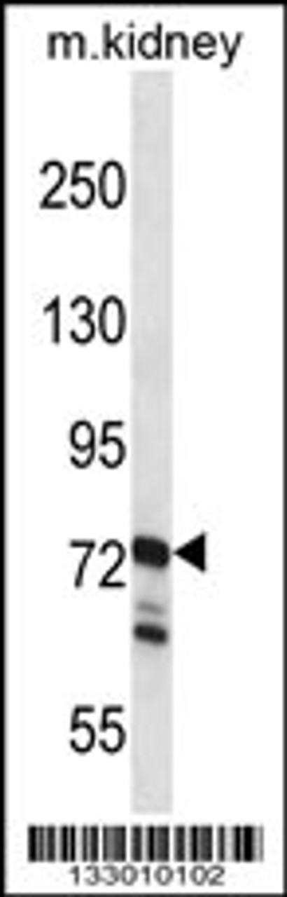 Western blot analysis in mouse kidney tissue lysates (35ug/lane) .