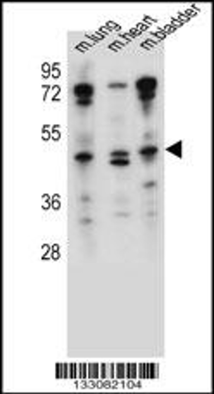 Western blot analysis in mouse lung, heart, bladder tissue lysates (35ug/lane) .