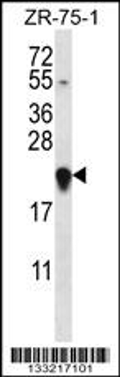 Western blot analysis in ZR-75-1 cell line lysates (35ug/lane) .