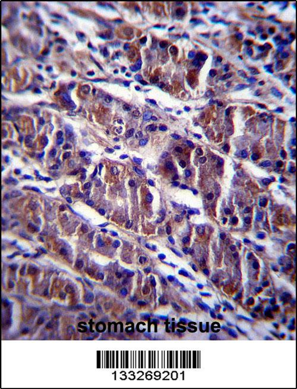 HDAC7 Antibody immunohistochemistry analysis in formalin fixed and paraffin embedded human stomach tissue followed by peroxidase conjugation of the secondary antibody and DAB staining.