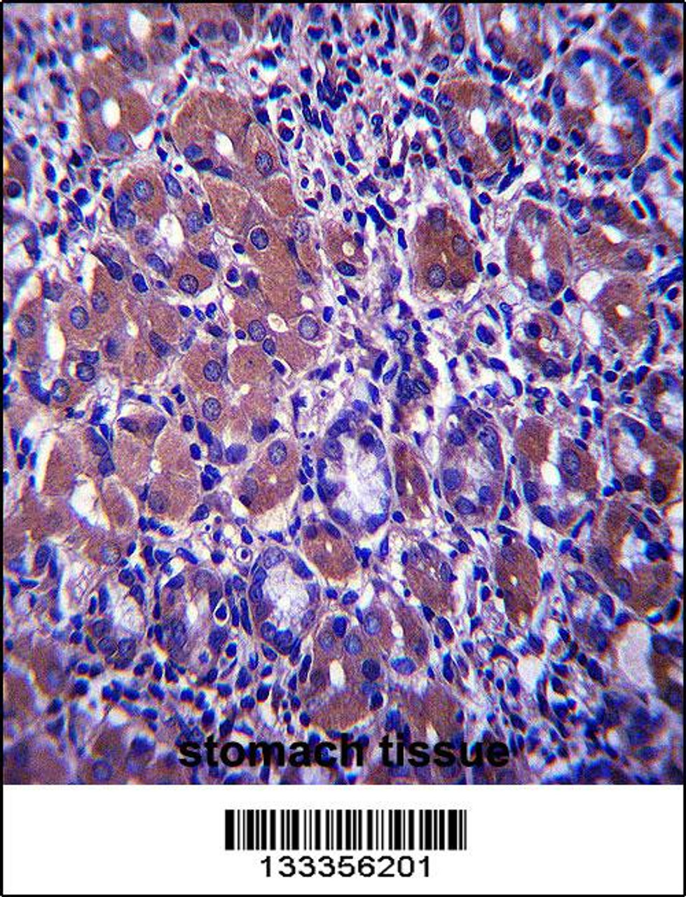 B4GALNT3 Antibody immunohistochemistry analysis in formalin fixed and paraffin embedded human stomach tissue followed by peroxidase conjugation of the secondary antibody and DAB staining.