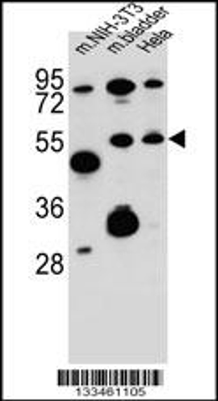 Western blot analysis in mouse NIH-3T3 cell line and mouse bladder tissue and Hela cell line lysates (35ug/lane) .